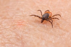 How to remove a Tick?